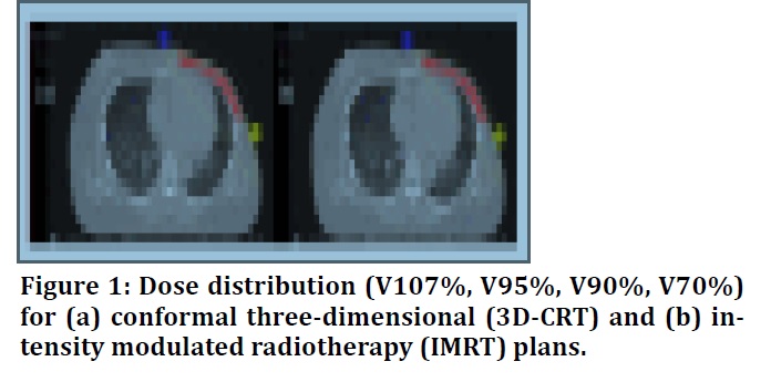 breast cancer treatment